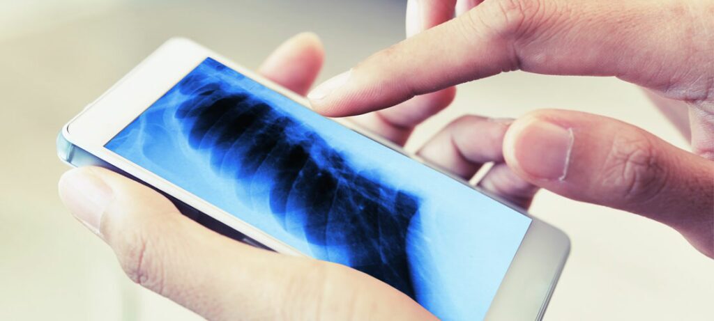 A doctor views an x-ray on his mobile phone.